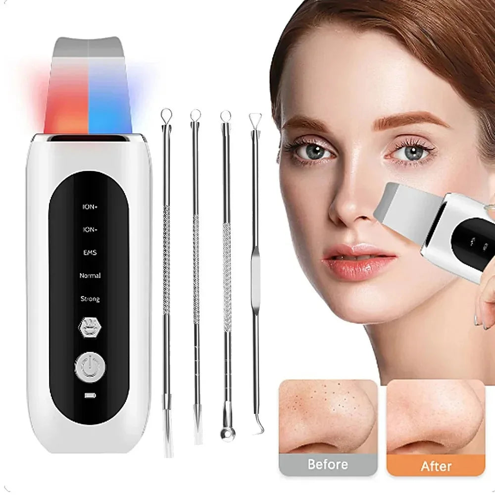 Ultrasonic Skin Scrubber 5 Modes LED