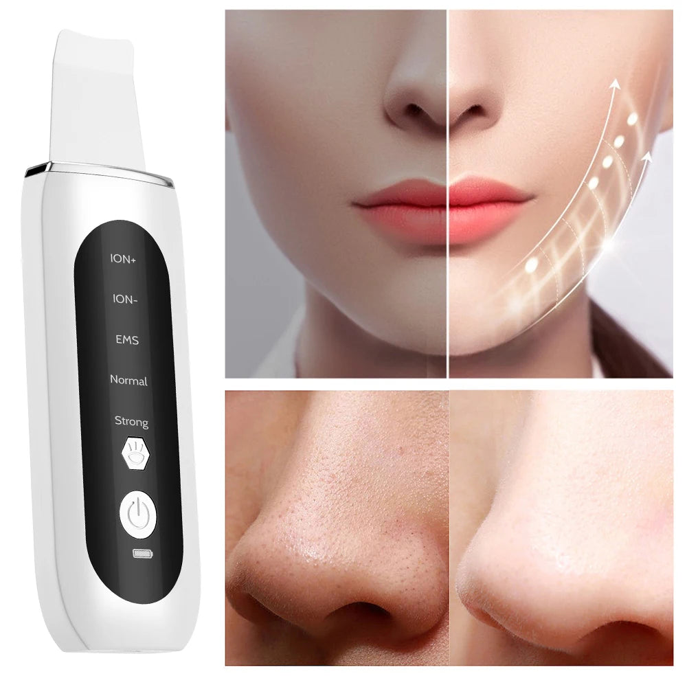 Ultrasonic Skin Scrubber 5 Modes LED
