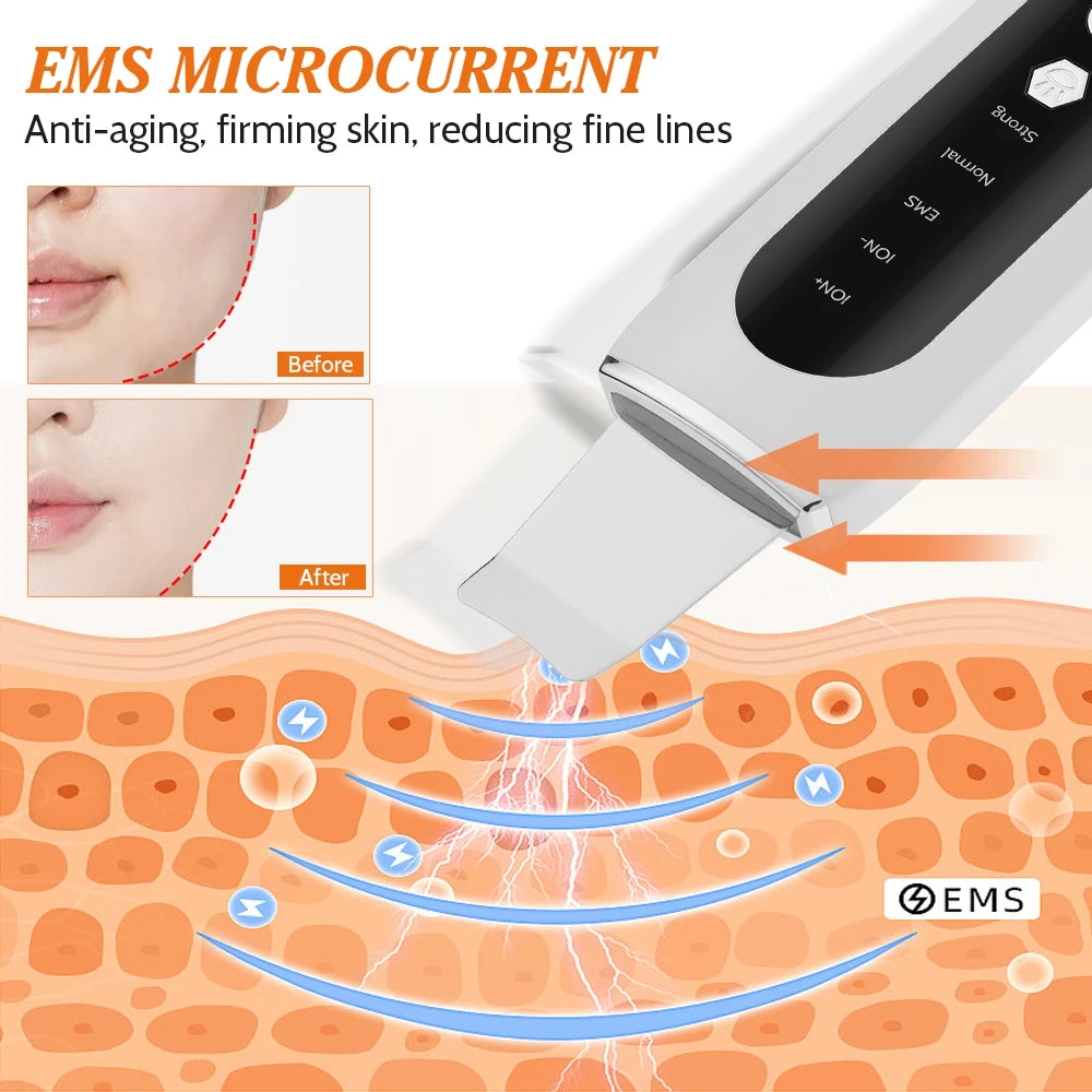 Ultrasonic Skin Scrubber 5 Modes LED
